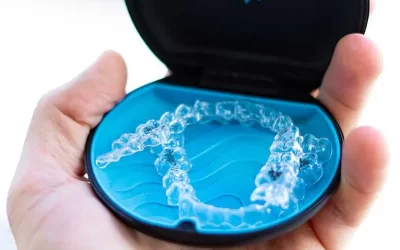 Key Considerations for Starting Invisalign in Chico and Oroville